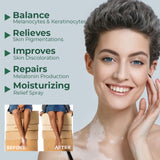 Vitiligo Relief Cream, Repair White Spots Flower Spots Skin Topical Care Ointment - V.I.P Digital Presence