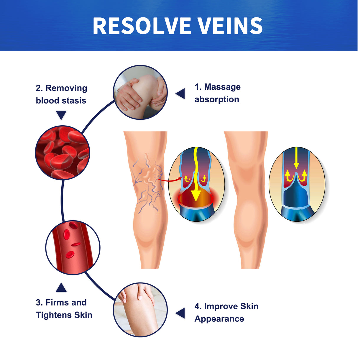 Vein Massage Varicose Cream Repair Earthworm Legs To Relieve Leg Blood Vessel Bulge And Varicoidea - V.I.P Digital Presence