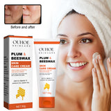 Beeswax Skin Cream Moisturizes Skin, Relieves Dry Skin, Sunburn, Mosquito Bites And Itch Relief Cream - V.I.P Digital Presence