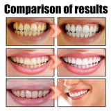 EELHOE   Oral Coconut Oil Mouthwash Removes Stains Beautifies Teeth Freshens Breath Cleans Mouth And Protects Gums - V.I.P Digital Presence