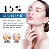 Niacinamide Facial Essence, Brightening, Firming, Hydrating And Whitening Essence - V.I.P Digital Presence