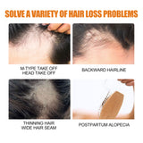 Hair Growth Spray, Men Hair And Beard Thickening Strengthening Anti-loss Care Solution - V.I.P Digital Presence