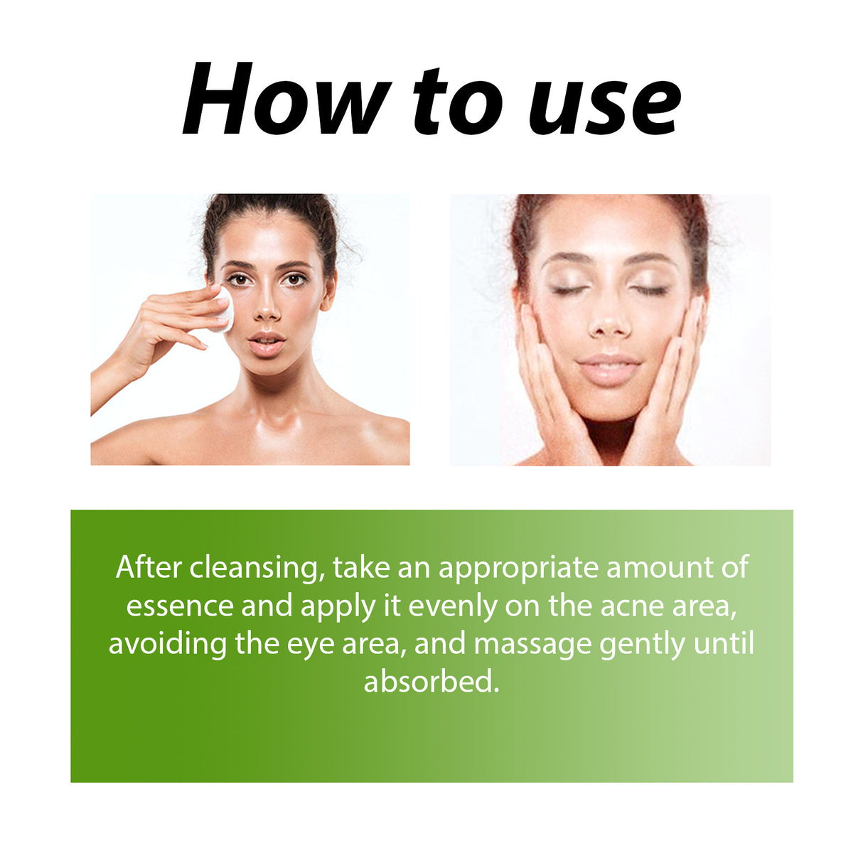 Herbal Acne Serum, Reduce Acne Pimples With A Comprehensive Moisturizing Moisturizer - V.I.P Digital Presence