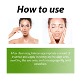 Herbal Acne Serum, Reduce Acne Pimples With A Comprehensive Moisturizing Moisturizer - V.I.P Digital Presence