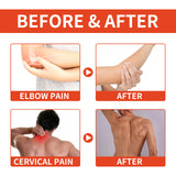 Bee Venom Patch, Relieve Hand-Foot Flexure Joint Shoulder Neck Lumbar Knee Soreness Care Body Patch - V.I.P Digital Presence