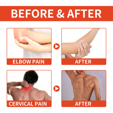 Bee Venom Patch, Relieve Hand-Foot Flexure Joint Shoulder Neck Lumbar Knee Soreness Care Body Patch - V.I.P Digital Presence