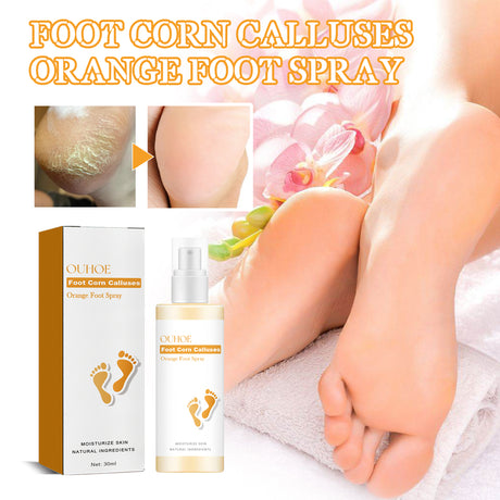 Foot Calluses Moisturizing Spray, Repair Heel Calluses, Remove Dead Skin, Moisturize And Moisturize Foot Care - V.I.P Digital Presence