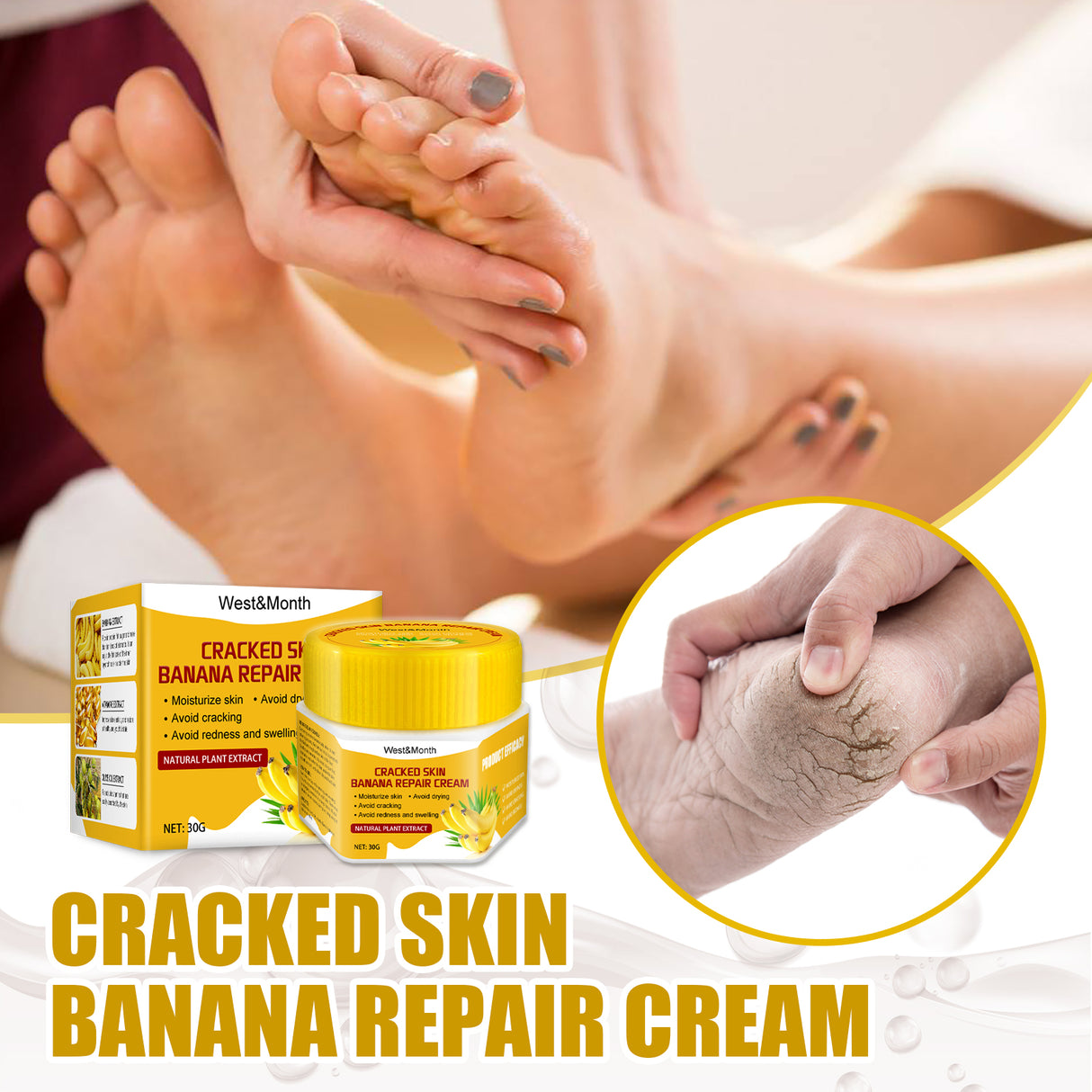 Cracked Skin Banana Repair Cream, Nourishing And Moisturizing Foot Repair Cream To Soften Exfoliation And Remove Dead Skin Calluses - V.I.P Digital Presence