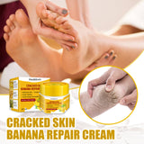 Cracked Skin Banana Repair Cream, Nourishing And Moisturizing Foot Repair Cream To Soften Exfoliation And Remove Dead Skin Calluses - V.I.P Digital Presence