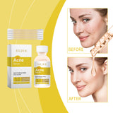 Face Essence Improve Acne Muscle Acne Closing Gentle Cleansing Face Skin Face Essence - V.I.P Digital Presence
