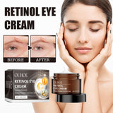 Retinol Eye Cream, Desalination Smoothen Fine Lines Eye Pouch Black Rim Of The Eye Moist Nursing Play Tight Muscle Eye Cream - V.I.P Digital Presence