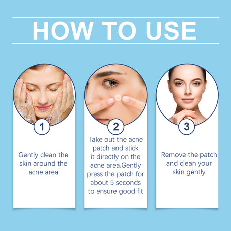 Day And Night Acne Cover Face Acne Patch Comfortably Repair Skin Oil Control Cover Acne Patch - V.I.P Digital Presence