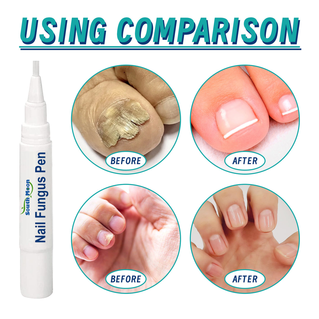 Nail Repair Pen, Repair Hands And Feet Gray Nails Brightening Nails Soft Nails Thickening Nails Moisturizing Care - V.I.P Digital Presence