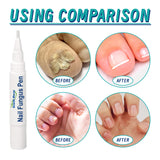 Nail Repair Pen, Repair Hands And Feet Gray Nails Brightening Nails Soft Nails Thickening Nails Moisturizing Care - V.I.P Digital Presence