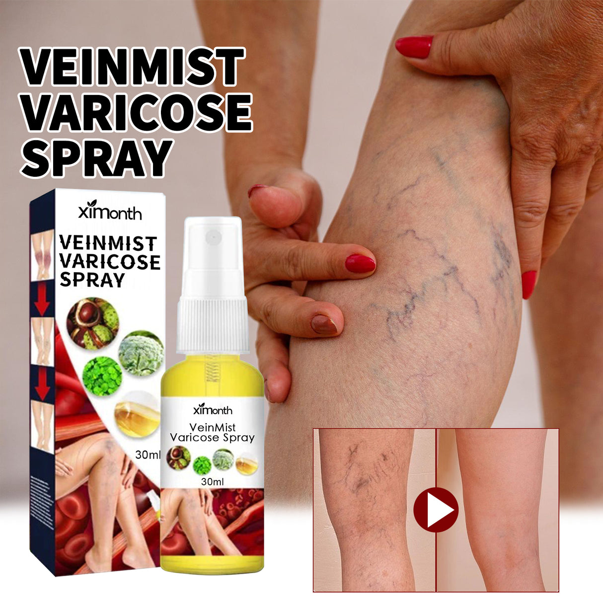 Veinmist Varicose Spray, Relief Sore Legs Massage Earthworm Leg Vein Treatment Spray - V.I.P Digital Presence