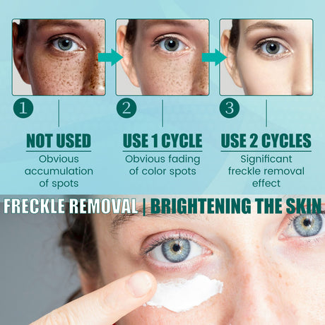 Facial Care Cream Facial Skin Moisturizing And Hydrating Spot Repair Skin Care Cream - V.I.P Digital Presence