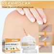 Desalting Skin Scar Cream, Skin Burn Scalding Surgical Scar Wound Repair Cream - V.I.P Digital Presence