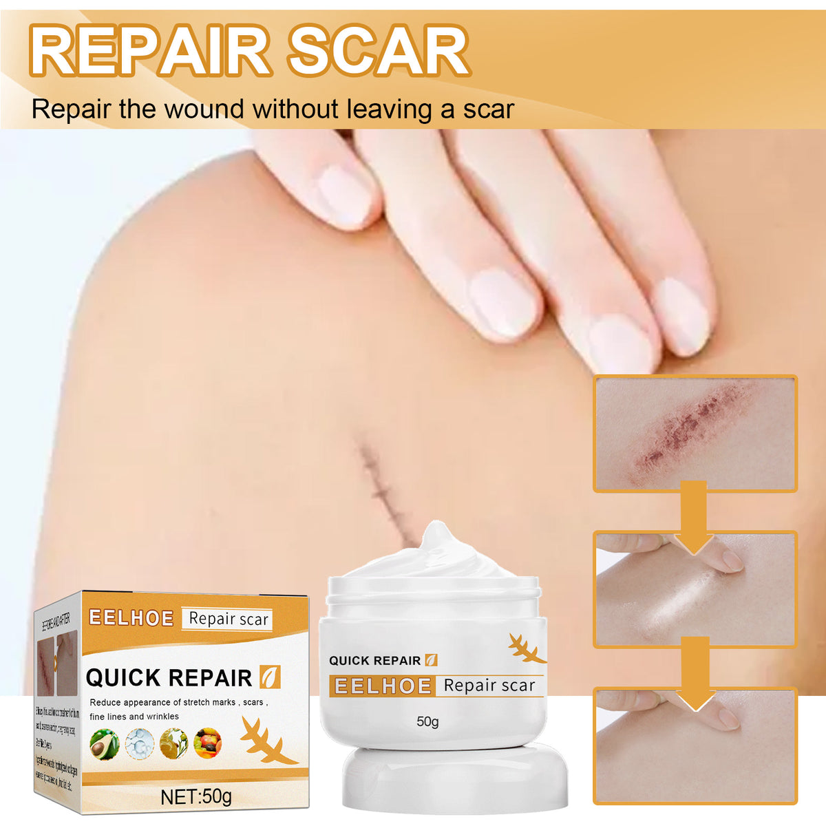 Desalting Skin Scar Cream, Skin Burn Scalding Surgical Scar Wound Repair Cream - V.I.P Digital Presence
