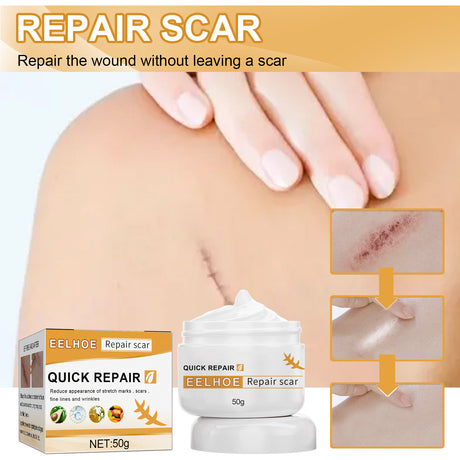 Desalting Skin Scar Cream, Skin Burn Scalding Surgical Scar Wound Repair Cream - V.I.P Digital Presence