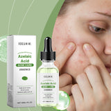 Azelaic Acid Facial Essence Moisturizes And Improves The Skin For Blackheads And Acne