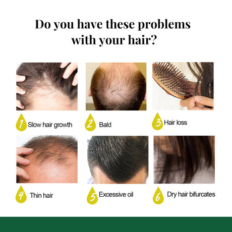 Ginger Hair Spray, Strengthens Hair, Massages Scalp And Restores Hair - V.I.P Digital Presence
