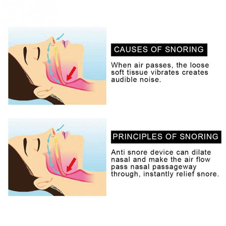 Upgrated Anti-snore Nose Purifier Snoring Aid Stopper Device Nose Vents Air Filter - V.I.P Digital Presence