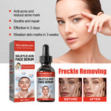 Salicylic Acid Facial Essence Hydrating Repair Improve Skin Care Essence - V.I.P Digital Presence