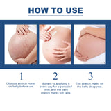 Scar Balm, Surgery Scar Repair Cold Compress Scar Skin Scar Gel Balm - V.I.P Digital Presence