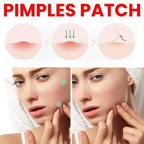 JaysuingRepair Acne Patch Facial Skin Care Fade Blemishes Pimple Marks Closed Acne Blemishes Cover Acne Pimple Repair Patch - V.I.P Digital Presence