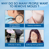 Wart Removers Seal & Heal Patches, Lightening Mole Gram Wart Repair Meat Grain Callus Corns Skin Clean And Smooth Patch - V.I.P Digital Presence