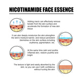 Nicotinic Acid Face Essence Lighten Acne Marks, Moisturize Pores, Shrink And Whiten Skin Beauty Essence - V.I.P Digital Presence