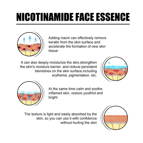 Nicotinic Acid Face Essence Lighten Acne Marks, Moisturize Pores, Shrink And Whiten Skin Beauty Essence - V.I.P Digital Presence