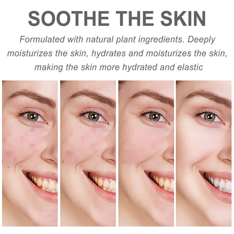 Centella Hydra Cream Brightening, Firming, Hydrating And Smoothing Fine Lines Cream - V.I.P Digital Presence