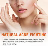 Salicylic Acid Facial Mask Gentle Cleansing Mask To Lighten Acne, Seal And Tighten Pores - V.I.P Digital Presence