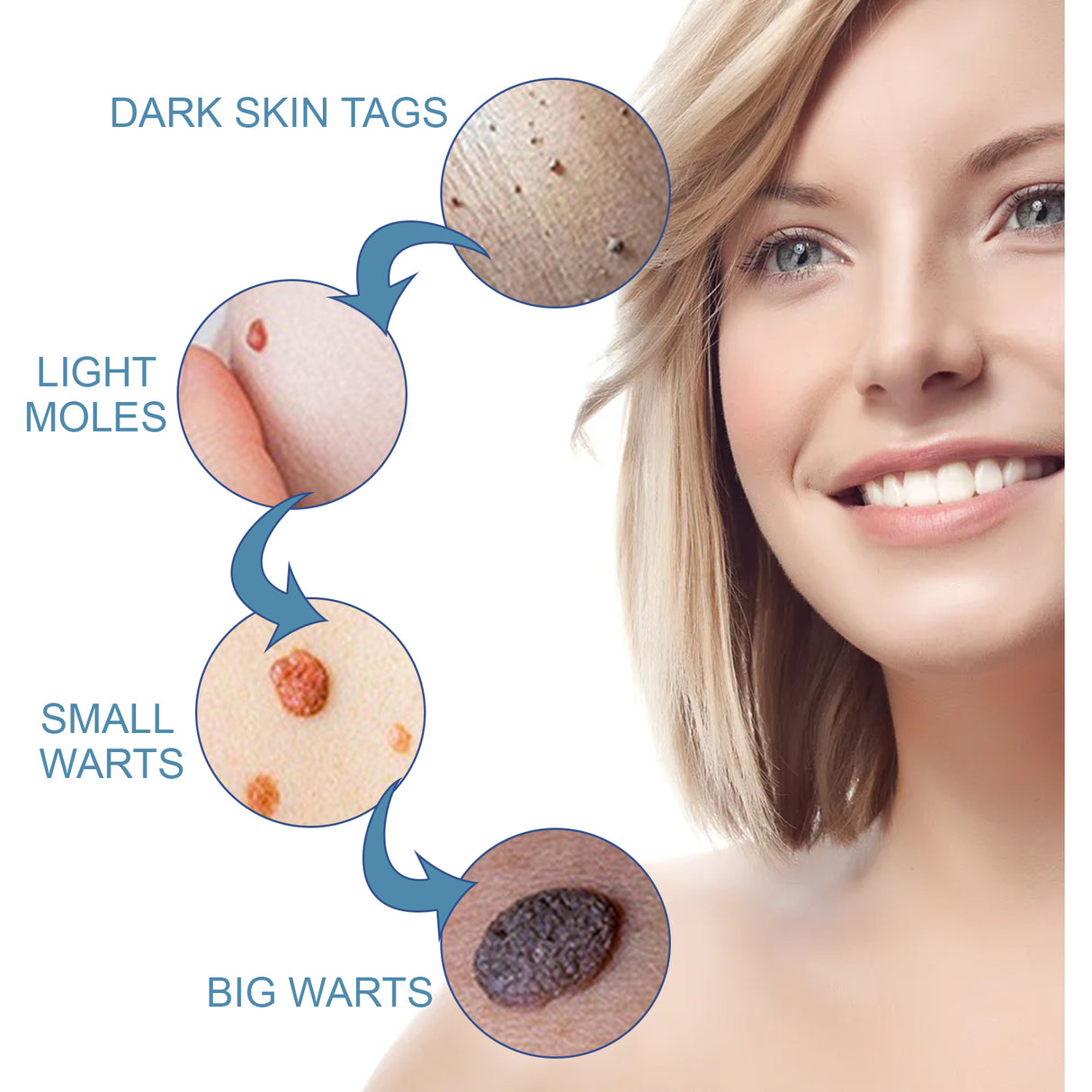 Wart Cream, Skin Clean And Smooth Wart Nevi Facial Care Cream - V.I.P Digital Presence