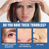 5 Seconds Retinol Cream To Reduce Fine Lines Under Eyes Hydrating Moisturizing Cream To Soften Skin - V.I.P Digital Presence