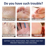 Anti-Crack Repair Hand Cream, Improves Cracked Rough Skin, Removes Dead Skin And Hydrates Hands And Feet Cream