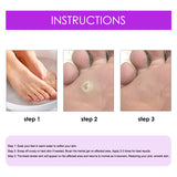 Remove Chicken Eye Lotion Extra Clear Remove Corns Skin Care Chicken Calluses Foot Pad Gram Warts - V.I.P Digital Presence