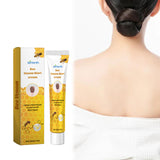 Bee Venom Wart Cream, Repair Smooth Skin Lightening Nevus Spot Nevus Cure Wart Care Cream - V.I.P Digital Presence
