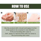 White Spot Purifying Serum For Whitening And Repairing White Spot Spot And Perspiration Spot Skin Moisturizing Serum - V.I.P Digital Presence