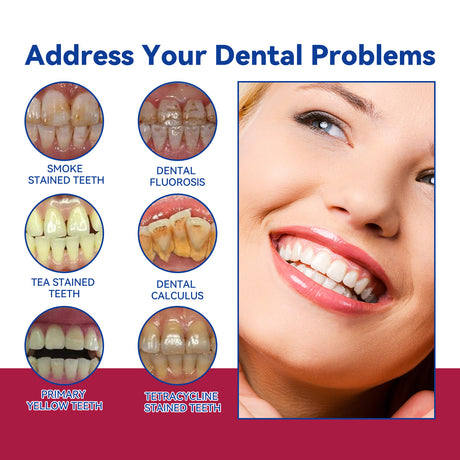 Anti-Cavity Gum Health Toothpaste, Clean Teeth Yellow Stains And Tartar Breath Fresh Clean Tooth Care Toothpaste - V.I.P Digital Presence