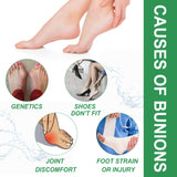 Bunion Relief Patch Corrects Thumb And Foot Joint Valgus And Relieves Swelling And Pain Foot Care Patch