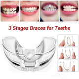 3 Stages Dental Orthodontic Braces Appliance Braces Alignment Trainer Teeth Retainer Bruxism Mouth Guard Teeth Straightener - V.I.P Digital Presence