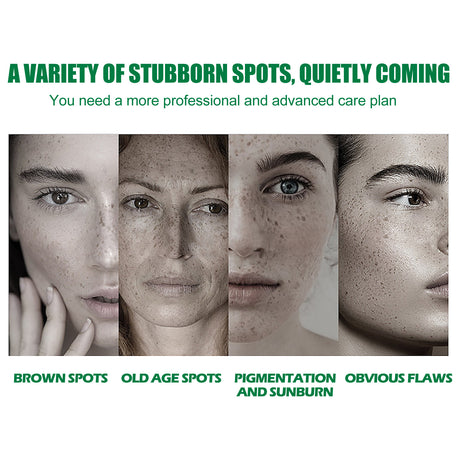 Dark Spot Correcting Glow Serum, Beauty Skin Stains Freckles Melanin Repair Dark Skin Care - V.I.P Digital Presence
