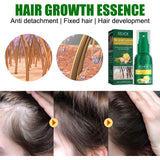 Ginger Hair Growth Spray, Nourishing And Nourishing Hair Root, Hair Care Solution To Prevent Scalp Loss - V.I.P Digital Presence
