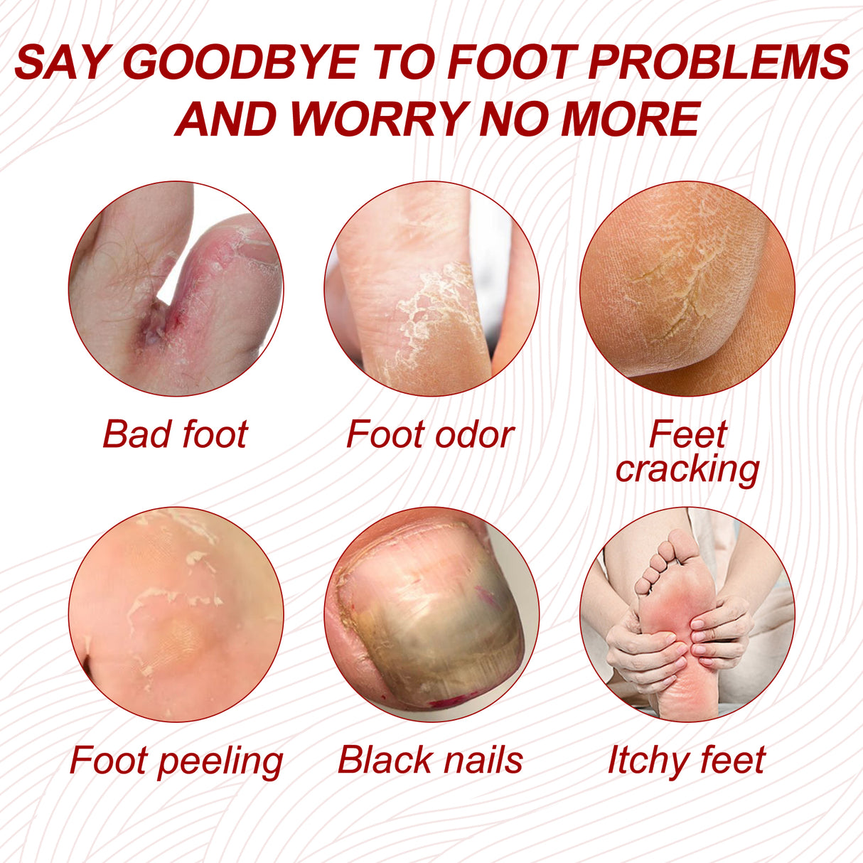 Nail Care Cream, Light Armor Repair Bad Ingrown Nail Nails Brothers Nail Thickening A Ditch Nursing - V.I.P Digital Presence