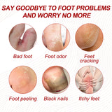 Nail Care Cream, Light Armor Repair Bad Ingrown Nail Nails Brothers Nail Thickening A Ditch Nursing - V.I.P Digital Presence