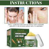 Herbal Acne-Removing Cream Anti-acne-Removing Cream Moisturizing Cleansing Cream Water Oil Balance Anti-acne-Removing Cream - V.I.P Digital Presence