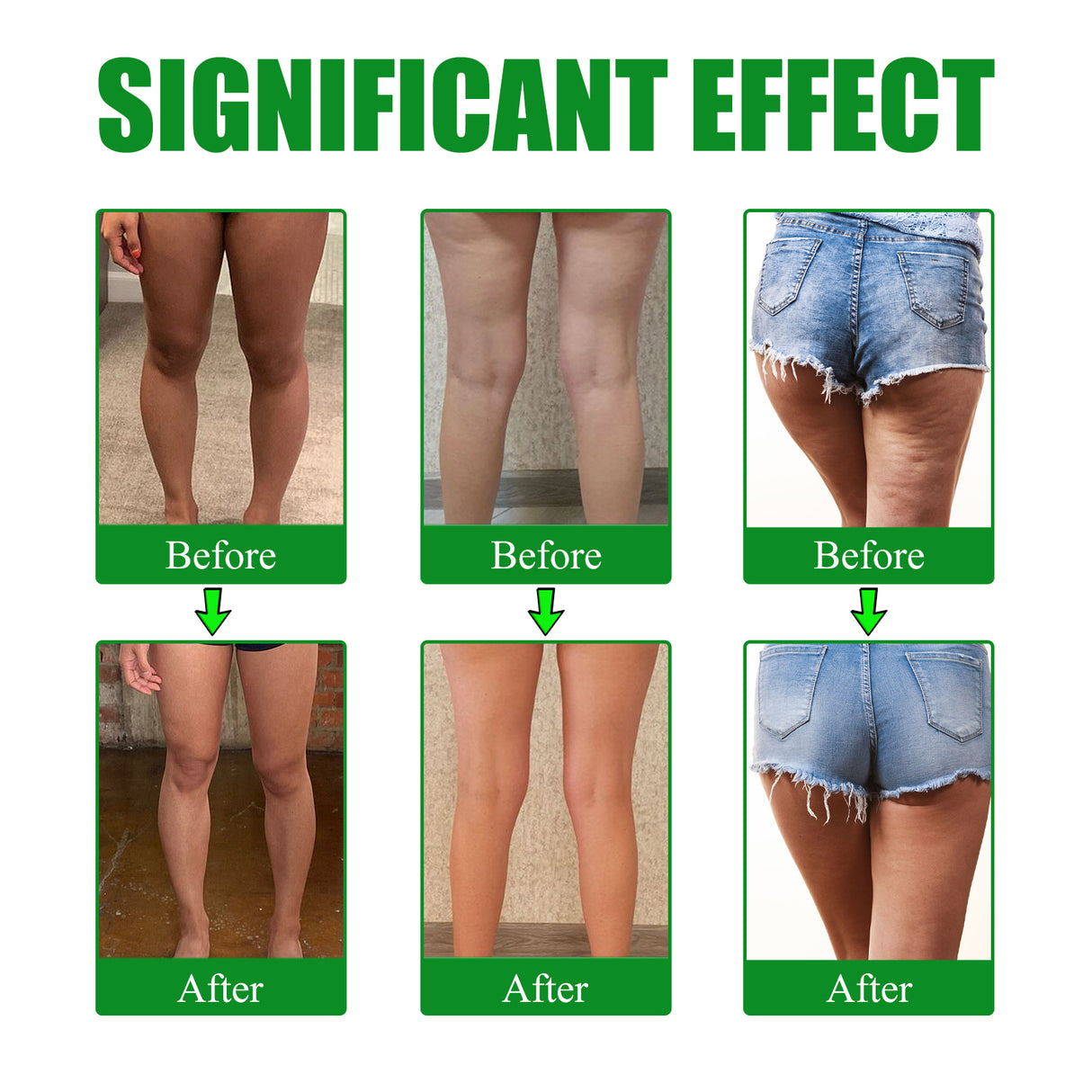 Moxa Leg Lift Paste, Tight Leg Fat, Anti-Orange Peel Shape Lazy People To Create Beautiful Slim Legs - V.I.P Digital Presence