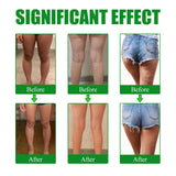 Moxa Leg Lift Paste, Tight Leg Fat, Anti-Orange Peel Shape Lazy People To Create Beautiful Slim Legs - V.I.P Digital Presence